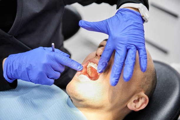 Best Emergency Dental Care for Broken or Chipped Teeth in Kent City, MI
