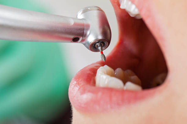 Best Emergency Treatment for Dental Infections or Abscesses in Kent City, MI